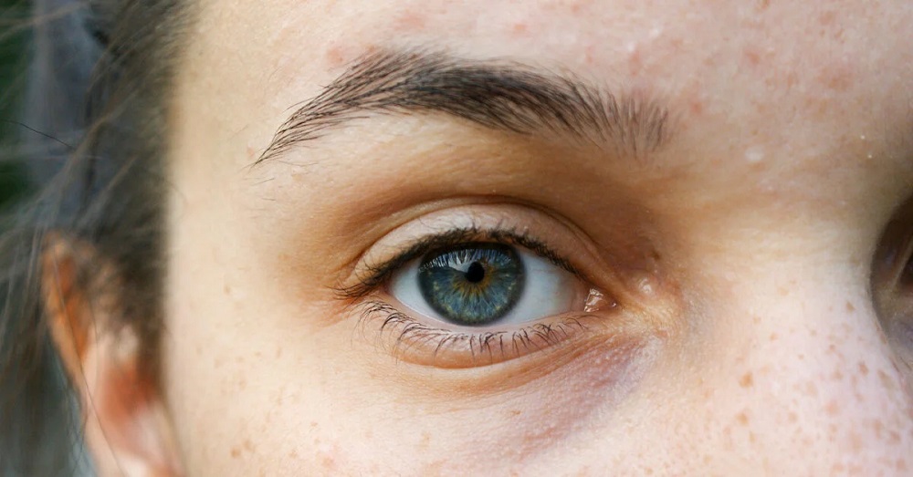 What Are Triple Eyelids, And What Are Its Causes?c